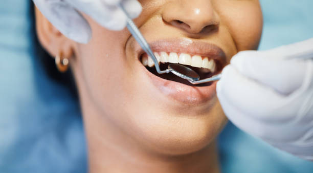 Best Emergency Dental Care for Broken or Chipped Teeth in Bellevue, WI